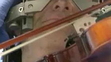 VIDEO INCREDIBIL! Un barbat canta la vioara in timpul operatiei pe creier!