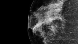 Se reprofilzeaza NASA?! Mai nou face si mamografii, folosind tehnologia pentru studierea cosmosului