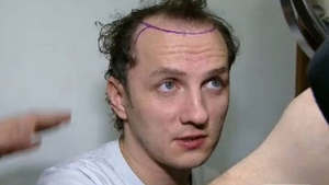 De cand si-a facut implant de par, Traistariu face ravagii printre femei! Artistul, agresat sexual: "Vrea doar sa ma f..."