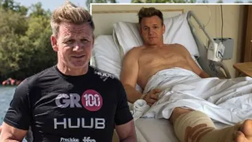 Chef-ul Gordon Ramsay, cu piciorul în ghips după un accident. Imagini de pe patul de spital!