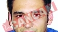 Care sunt cauzele sensibilitatii dentare si cum se poate trata