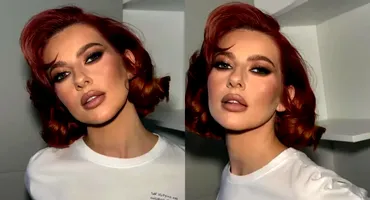 Lidia Buble și-a speriat fanii! A apărut cu fața inflamată și amorțită: „Nu arată rău. Acum e cel mai umflat”