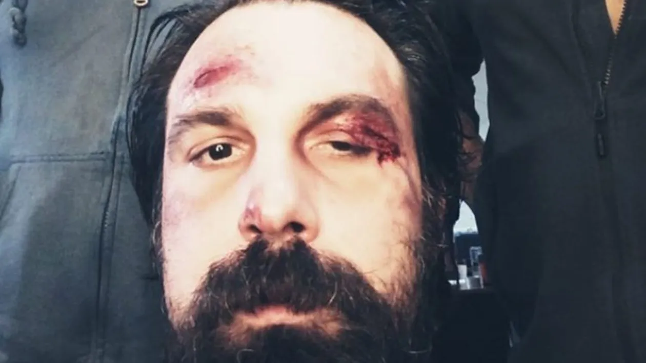 Alex Papadopol, desfigurat în bătaie după ce a fost prins la nudiști. Doar în filme vezi așa ceva!