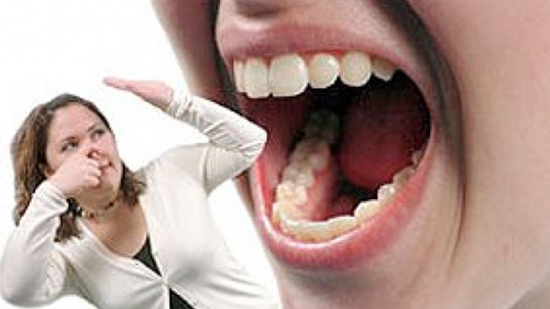 Probleme cu respiratia urat mirositoare? Vezi care sunt cauzele si cum poti preveni aceasta situatie