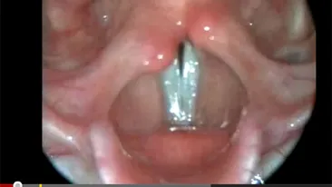 Te-ai gandit vreodata ca asa ceva face parte din corpul unei femei? Nu o sa ghicesti niciodata ce este!