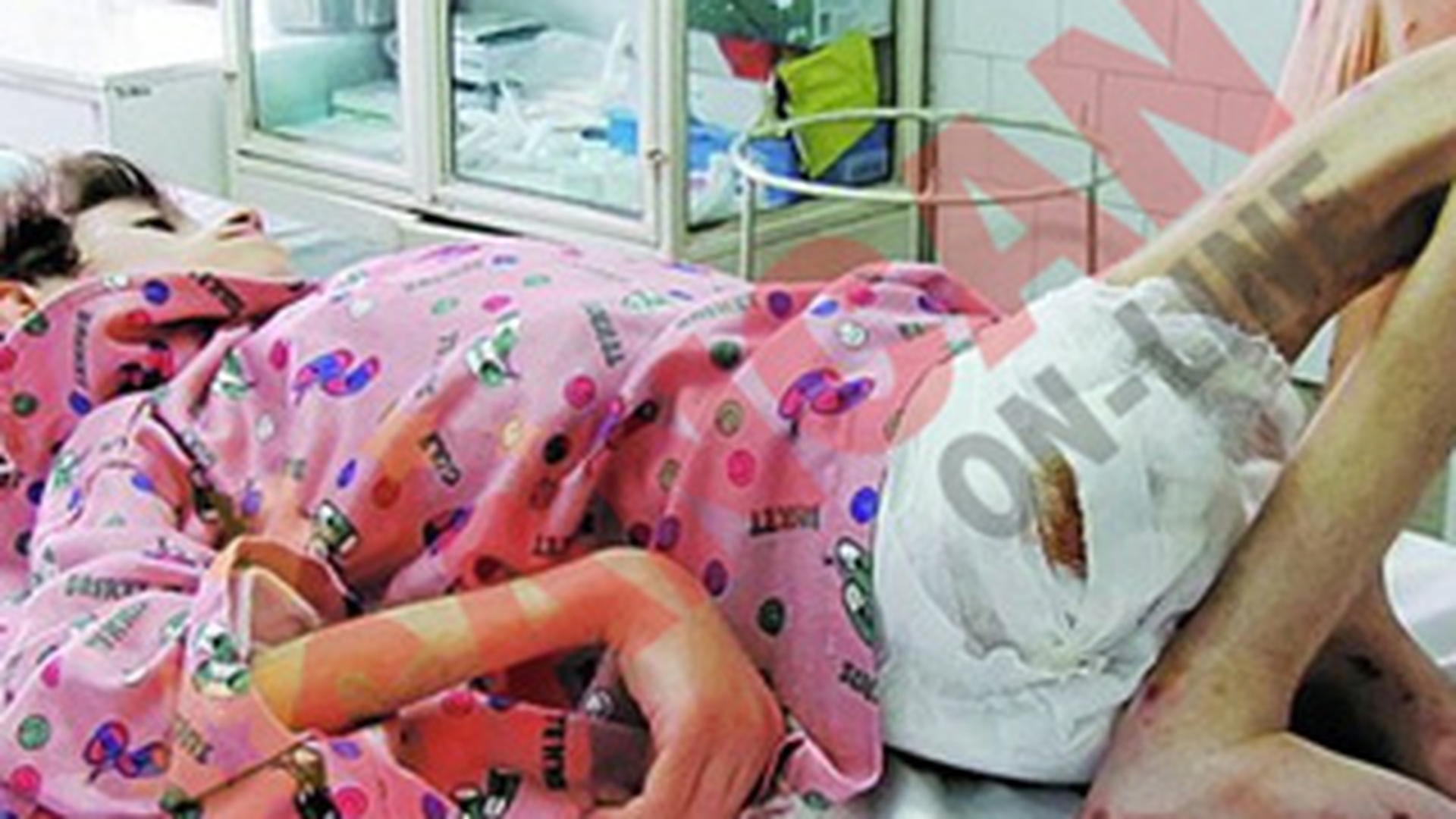 Fratele fetitei de 15 ani si 13 kilograme: "Gabriela a fost alimentata tot timpul"