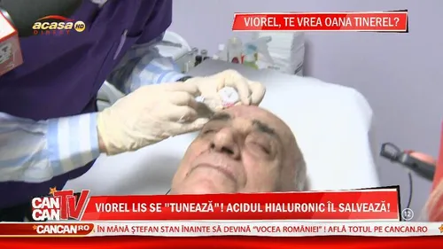 De asta mai avea nevoie? Viorel Lis s-a injectat cu acid in pometi! Vezi cum poata arata acum fostul primar!