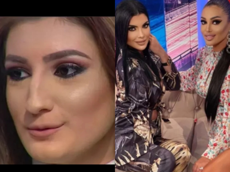 Lorena Tonciu a recunoscut că are mai multe operații estetice la nivelul feței/ sursă foto: social media