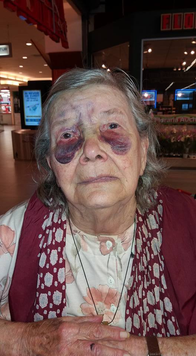 Bătrână, bătută de fiică şi ginere