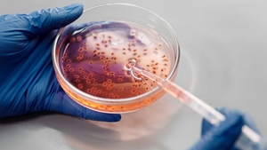 Bacteria extrem de periculoasă, care te poate ucide! În ce alimente o poți găsi