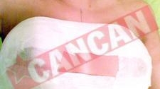 Si-a pus silicoane pe semnatura tatalui