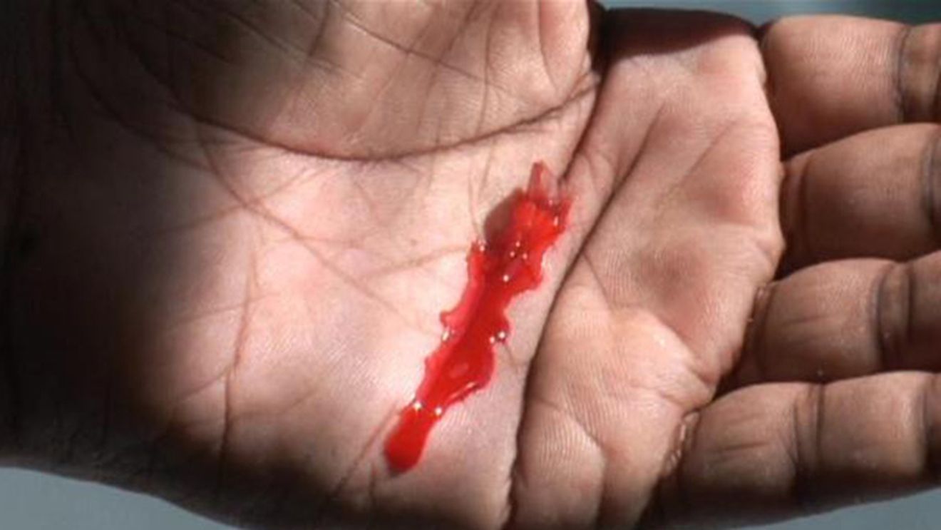 VIDEO Premiera in lumea medicinei! S-a inventat gelul care poate opri instantaneu orice hemoragie!