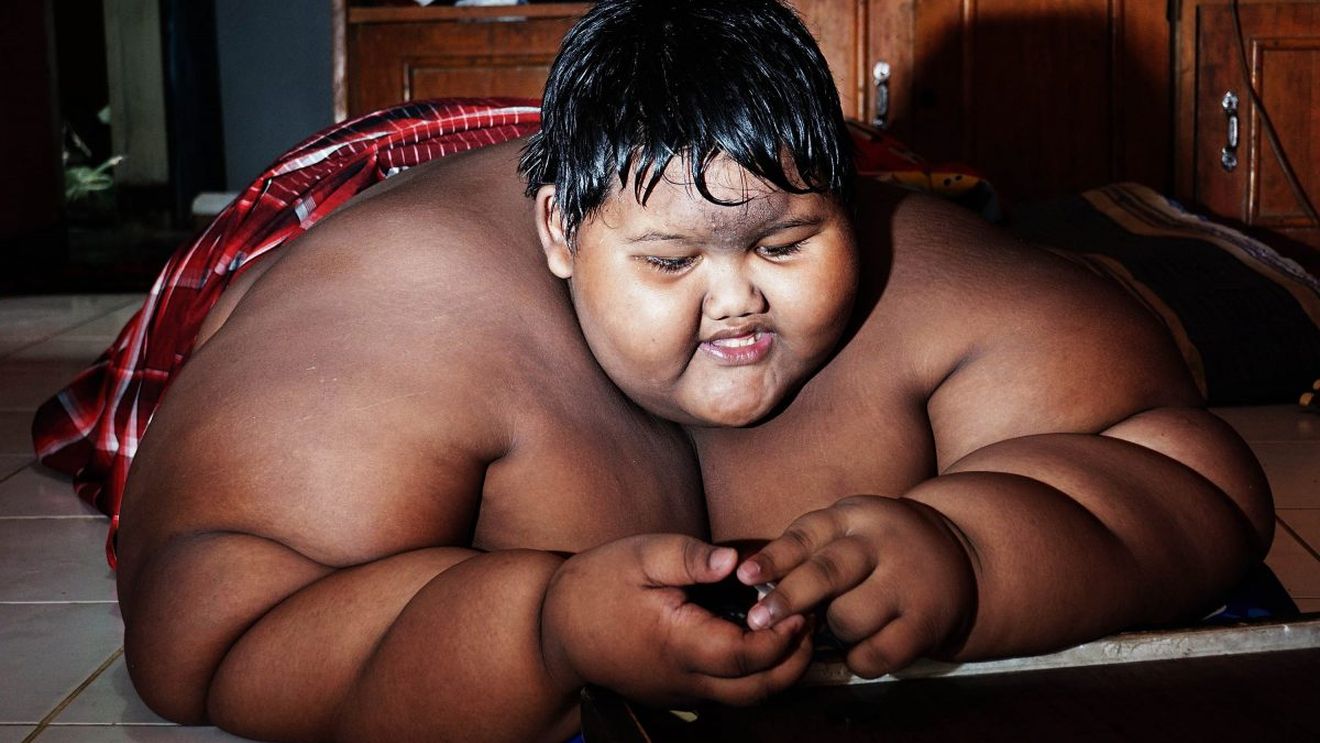 Transformare spectaculoasă! Arya Permana, poreclit „cel mai gras copil din lume”, a slăbit peste 100 de kilograme. Cum arată acum băiatul