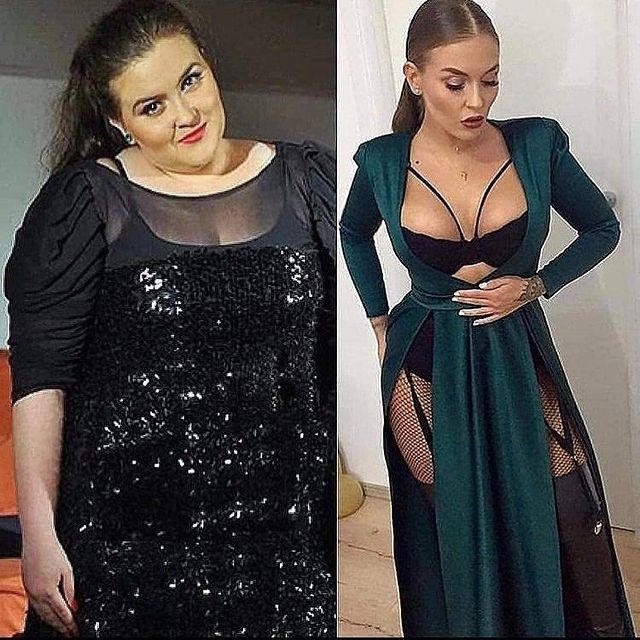 Oana Radu, total schimbată după operație (Foto: Facebook)