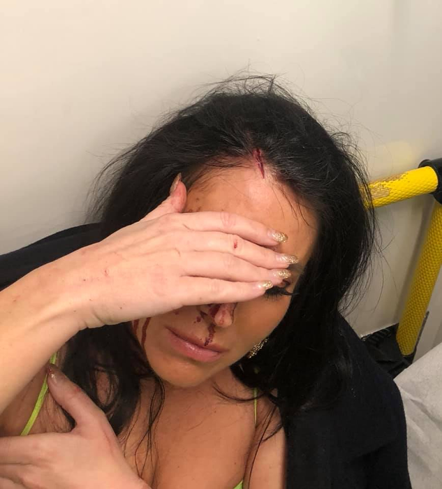 Prezentatoarea TV a ajuns plină de sânge la spital. Imagini cu puternic impact emoțional