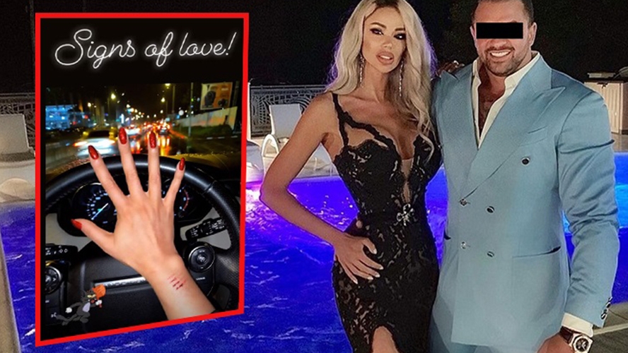 I-a înfipt furculița în mână când a aflat de divorț! Bianca Drăgușanu a ajuns la Urgențe după ce a fost agresată de soț: "A avut o coastă fisurată"