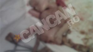 IMAGINI SOCANTE Caz foarte rar in lume! O femeie isi purta fatul mort de doua luni, in abdomen