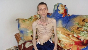 La 47 de ani, Eugen Movilă are doar 28 kg! “Nu am mai mâncat nimic de 3 ani”