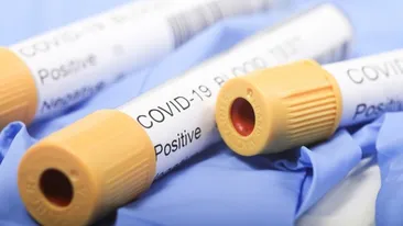 Primăria Capitalei vrea să suplimenteze numărul de beneficiari ai proiectului „Testăm pentru Bucureşti”