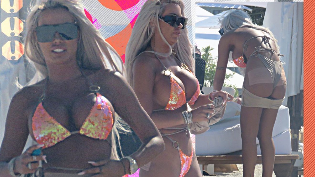 Loredana Chivu nu a scăpat de problemele pricinuite de injectarea feselor!