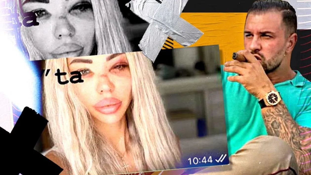 Bianca Drăgușanu, desfigurată de Alex Bodi! Imaginea care îngrozește pe oricine... ”Să vedem ce spun autoritățile despre bărbăția ta!” + Prima reacție a agresorului: ”Ai cerut bani, iar eu te-am plătit!”