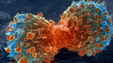 Atentie, romani! Ce se poate intampla daca bei apa de la robinet! Specialistii avertizeaza: CANCER!