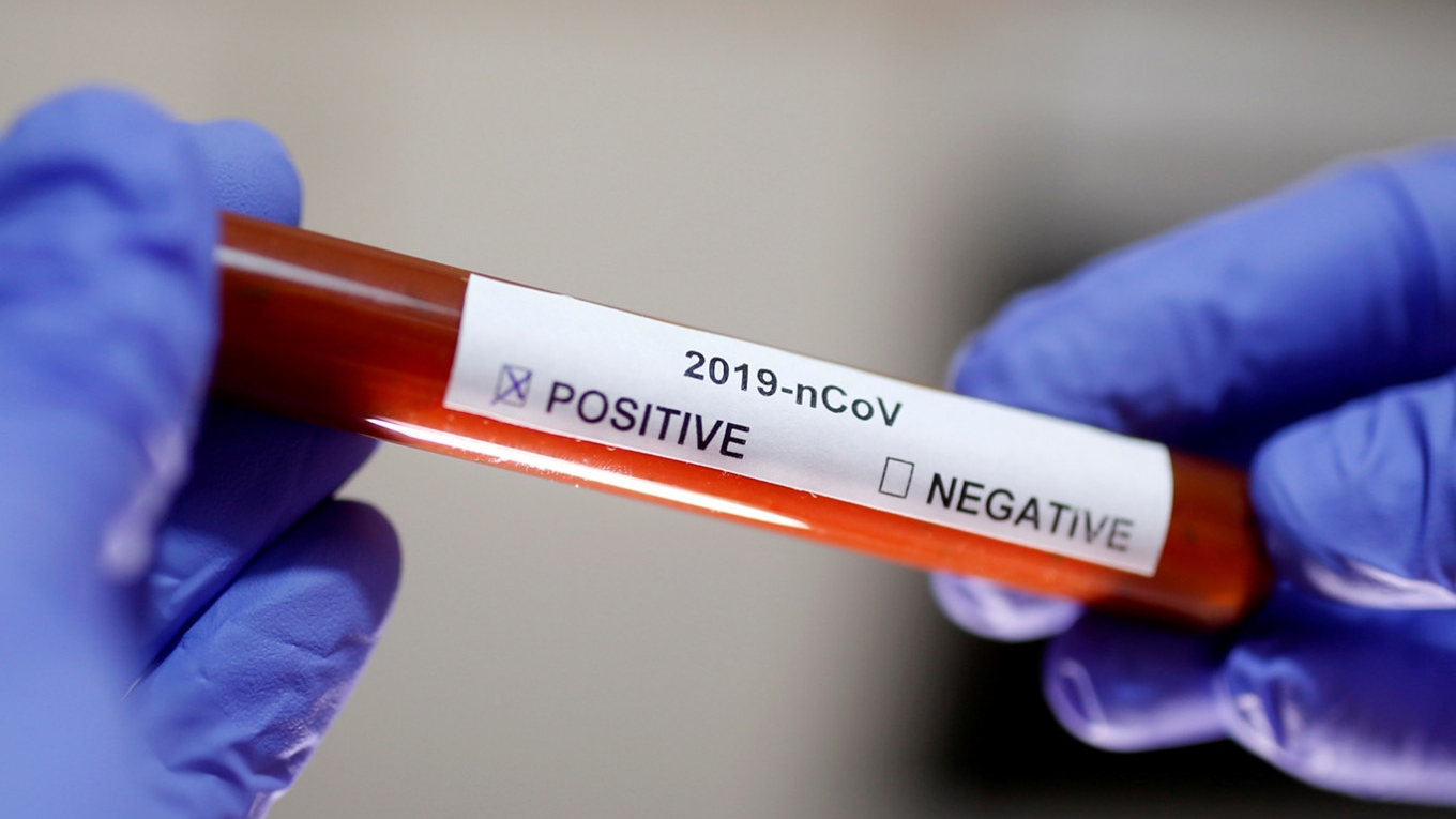 Este oficial! Un diagnostic pus greșit a dus la izbucnirea pandemiei de coronavirus
