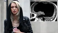 Andreea Bălan, complicații după stop-cardiac. A fost creierul afectat?! Am făcut două RMN-uri