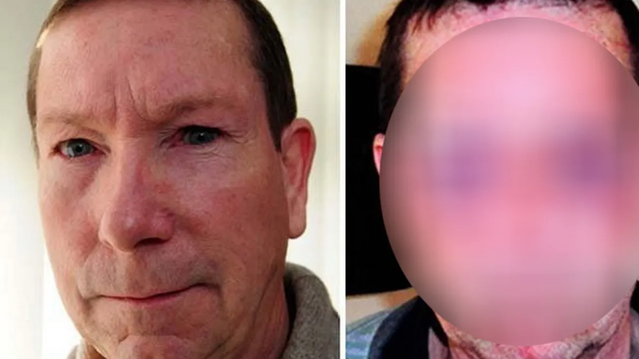 Cum arata fata acestui bunicut dupa ce a fost batut de un politist care a facut box: A primit 27.000 de euro despagubiri