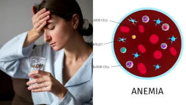 Cauzele ascunse ale carenței de fier. Mulți români ignoră simptomele!