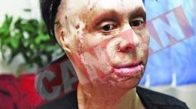A facut 20 de operatii de reconstructie a fetei