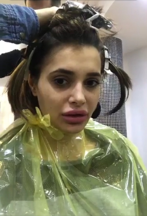 Diana de la „Insula Iubirii” şi-a îngrijorat fanii! A fost surprinsă cu vânătăi pe faţă: „Am pe aici, dar şi pe barbă”. Avem imaginile şi mărturisirile despre ce a păţit