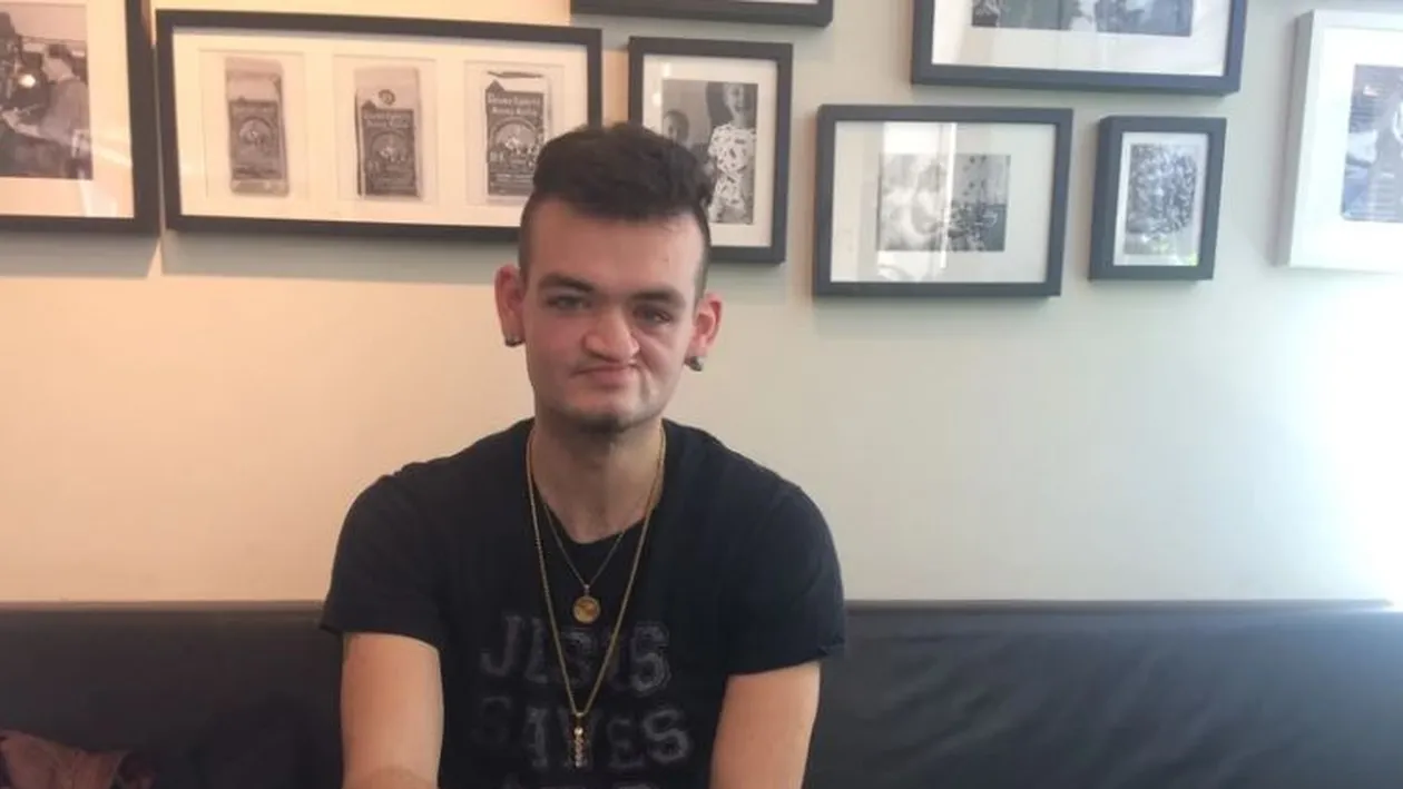 Povestea tulburătoare e tânărului care s-a născut cu Sindromul Alcoolic Fetal: ”Mama a băut mult!”