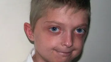 Are 11 ani, dar arata de 40! Un copil traieste clipe de cosmar