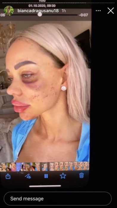 Alex Bodi a recunoscut! De ce a bătut-o, de fapt, pe fosta lui soţie, Bianca Drăguşanu: „Să dau eu într-o femeie trebuie să existe o sumedenie de provocări”