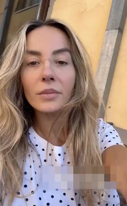 Cum arată Flavia Mihășan la 3 săptămâni de la operația la nas. Vedeta e schimbată total!