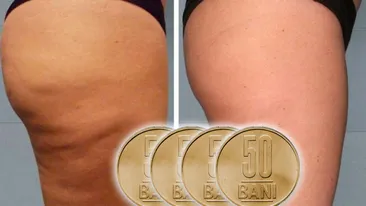 Alimentul de 2 lei care topește în timp record celulita! Puțini români știu acest lucru