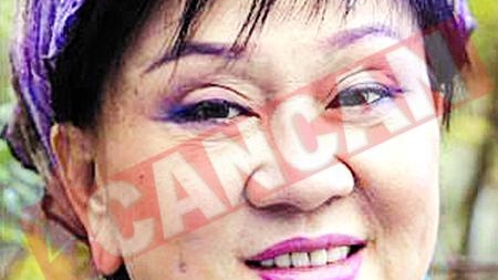 A facut peste 50 de operatii estetice