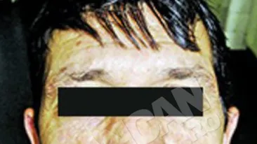 I-au pus un muschi pe post de limba!