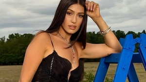 Alina Eremia și-a uimit fanii după ce a apărut cu fața umflată pe Instagram. Ce a pățit cântăreața în urmă cu puțin timp