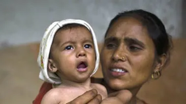 Copilul cu opt membre a fost salvat de medici!