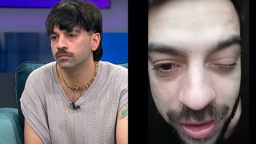 David Pușcaș s-a trezit cu ochiul umflat și a avut un șoc când s-a uitat în oglindă: ”Am vreo boală?”