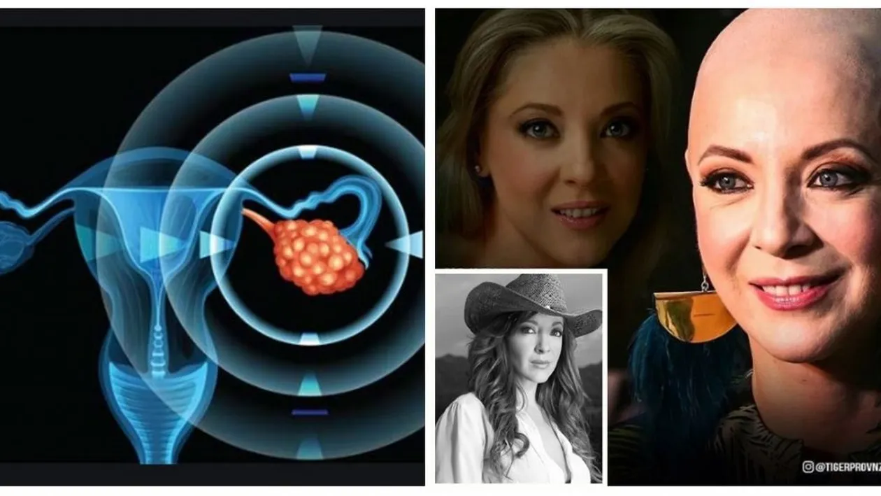 Care sunt simptomele cancerului ovarian, maladia care i-a adus sfârșitul lui Edith González