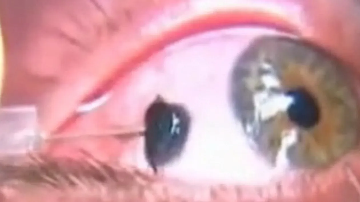 Transformare terifianta! Cum arata acest barbat dupa ce si-a tatuat ochii: Am plans cerneala timp de doua zile!