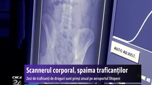 Sunt noile dispozitive de scanare corporală de pe Otopeni invazive și periculoase pentru sănătate?