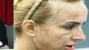 VIDEO Daniela Gyorfi, despre fotografiile in care apare cu fata distrusa: "Oi fi dalmatian si nu imi dau seama!"