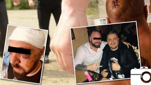 Ce a apărut pe pagina temutului interlop, la un an de când a fost snopit în bătaie: ”Am văzut moartea cu ochii...”