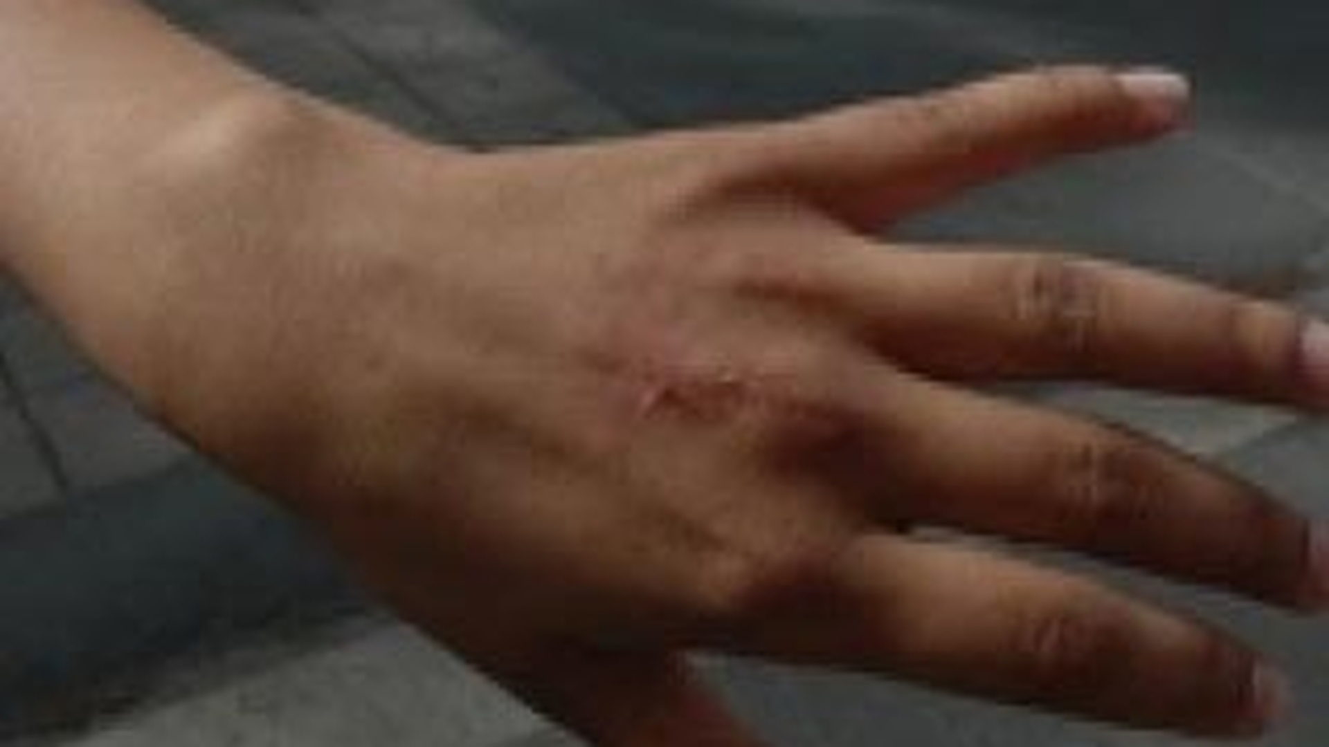 Un baiat de 17 ani din Sibiu a talharit doua tinere. Pe una dintre ele a muscat-o violent de mana