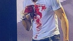 VIDEO! Se repeta istoria de la "Ferma Vedetelor!" Un celebru artist, plin de sange dupa un concert de groaza!