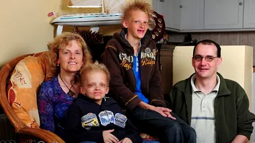 Caz socant! Doi copii sufera de vampirism!